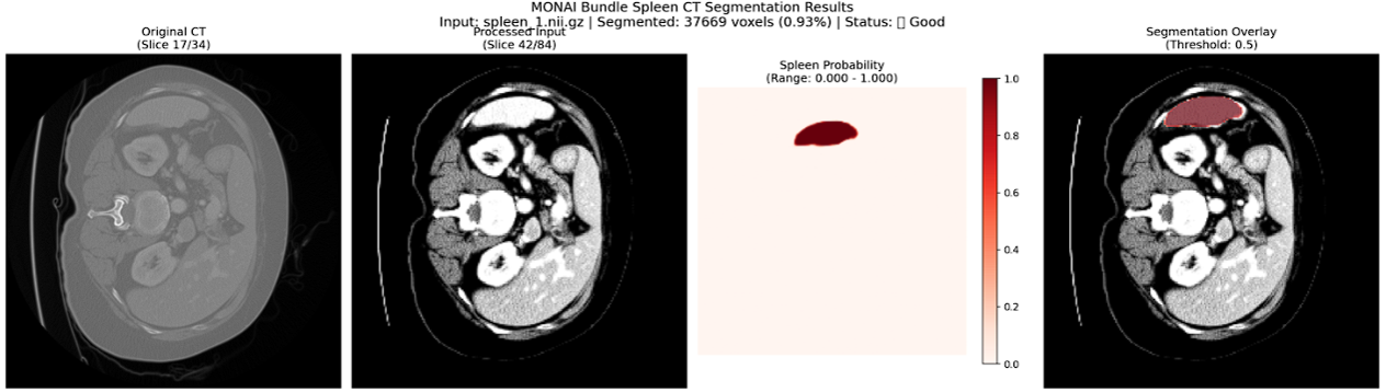Spleen Segmentation Results