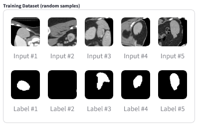 Spleen Segmentation Annotated Training Images